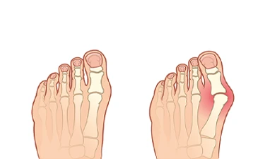 Foot Aesthetics (Cindrella Aesthetics)