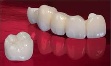 zirconium-dental-coating